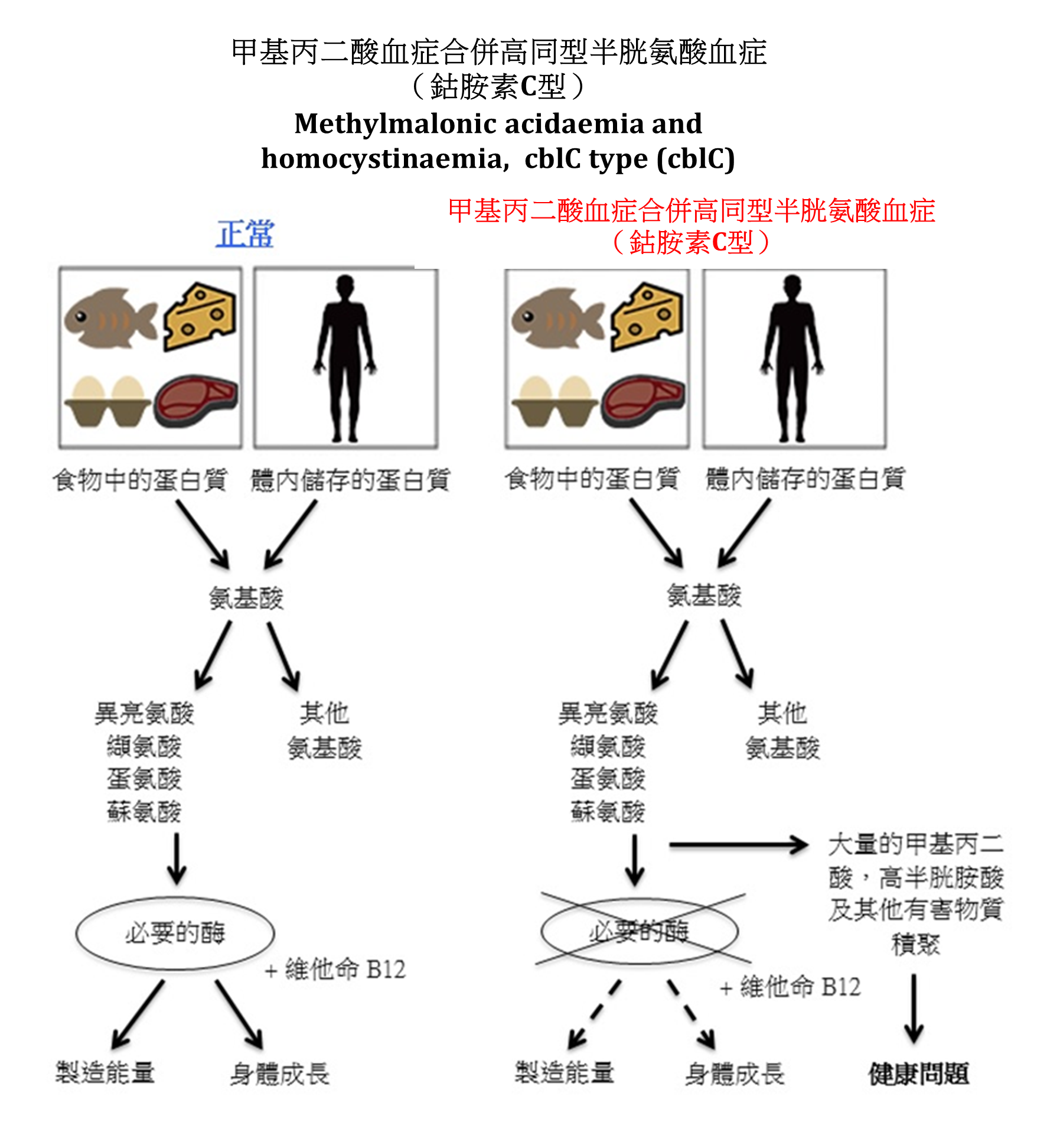 甲基丙二酸血症合併高同型半胱氨酸血症（鈷胺素C型） 圖解